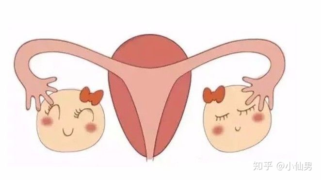 输卵管造影