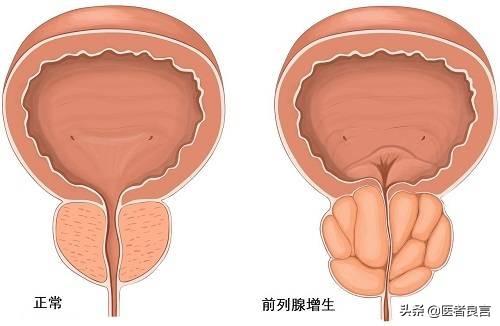 雌二醇低吃什么_雌二醇偏高_雌二醇