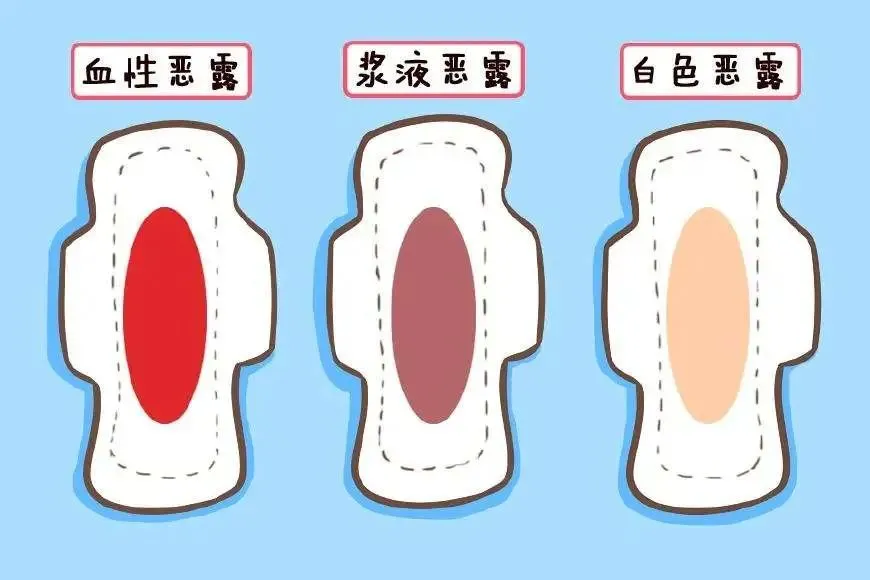 产后恶露_产后恶露多久_产后恶露反复