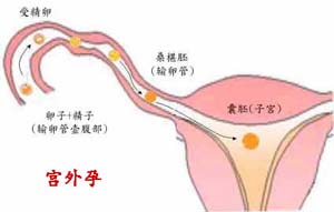 小月子_流产小月子注意事项_坐小月子注意事项