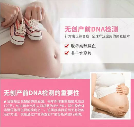 唐氏综合症