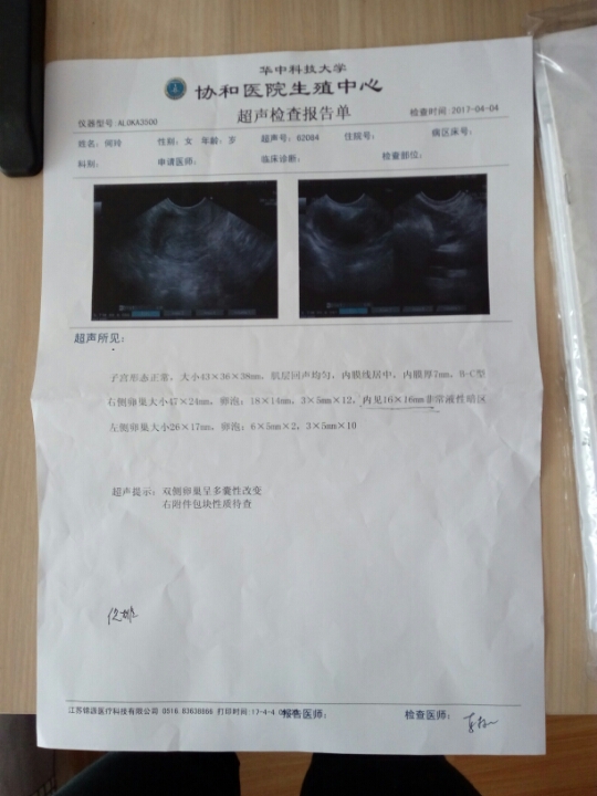 卵泡期雌二醇偏高促卵泡成熟激素偏低怎么办_窦卵泡计数_穿刺大卵泡,小卵泡能长大吗