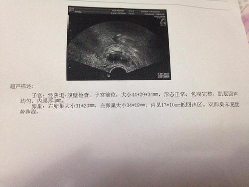 穿刺大卵泡,小卵泡能长大吗_窦卵泡计数_卵泡期雌二醇偏高促卵泡成熟激素偏低怎么办