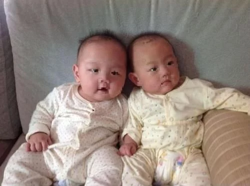 怎么生双胞胎