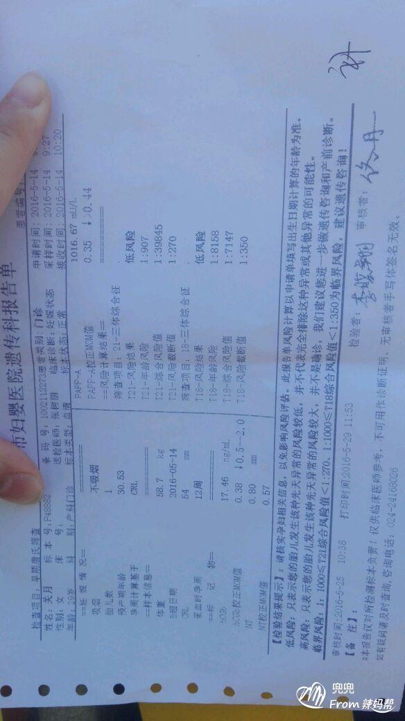 唐氏综合症_唐氏筛查综合值是1::425,参考值是1:250_唐氏综合筛查是什么