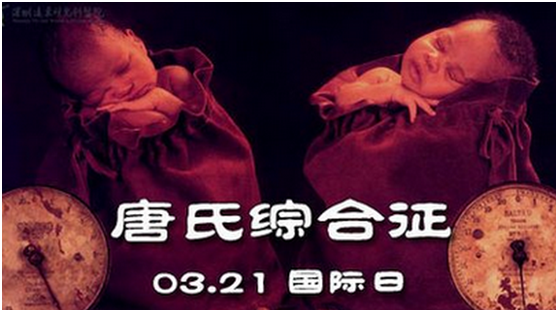 唐氏综合症