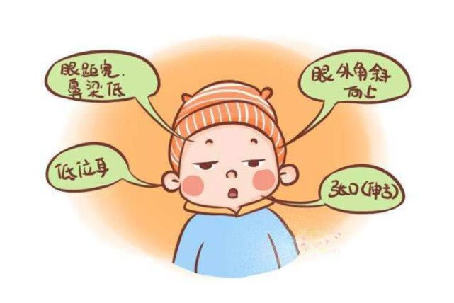 唐氏综合症_唐氏综综合图片_假日综合征和症