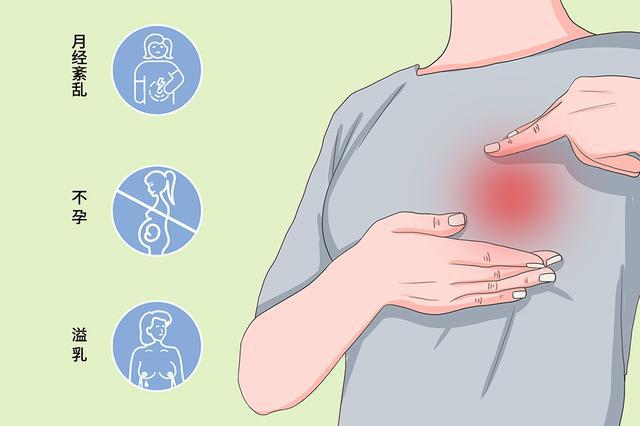 更年期催乳激素高有什么症状_催乳激素_变性人催乳激素