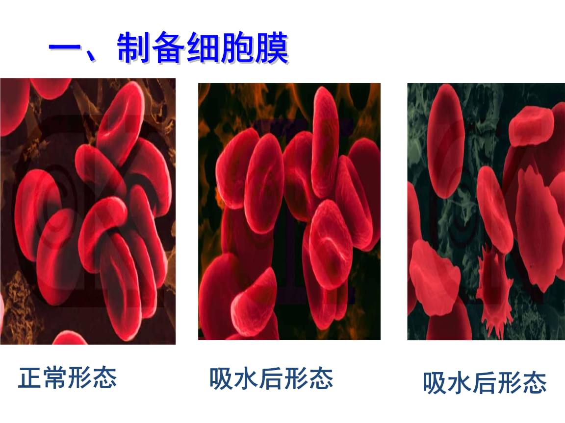 雨生红球藻细胞电子_红细胞_凋亡细胞与坏死细胞