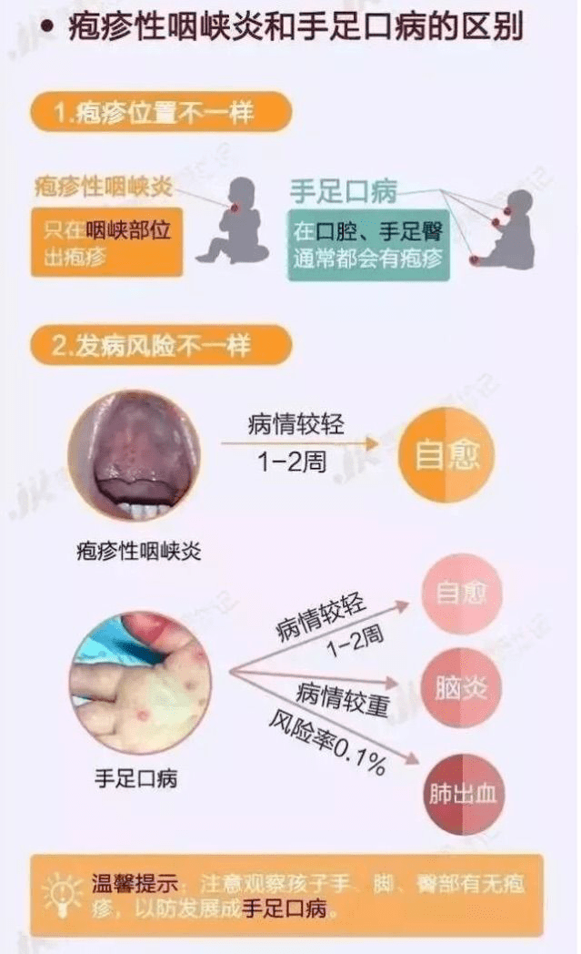 单纯疱疹病毒感染_单纯疱疹病毒_单纯疱疹