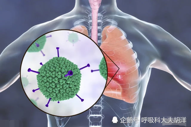 单纯病毒疱疹抗体igm_呼吸道病毒 单纯疱疹_单纯疱疹病毒