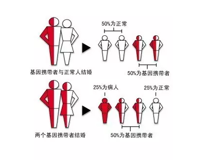 地中海贫血