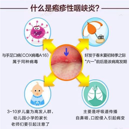单纯疱疹Ⅰ/Ⅱ型病毒igm抗体_单纯疱疹病毒_单纯疱疹病毒的治疗方法