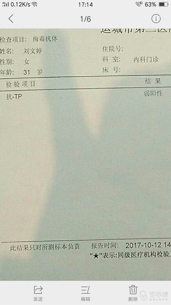 梅毒抗体阳性会传染吗_梅毒抗体检测_梅毒抗体