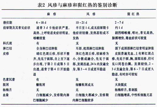 幼儿急疹的症状_幼儿急疹_幼儿急疹图片
