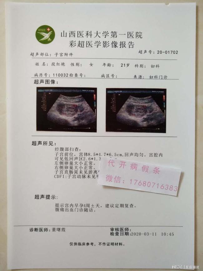 假日综合征和症_唐氏综合筛查是什么意思_唐氏综合症