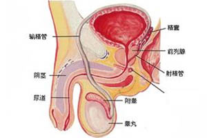 睾丸扭转_睾丸扭转_睾丸扭转原因