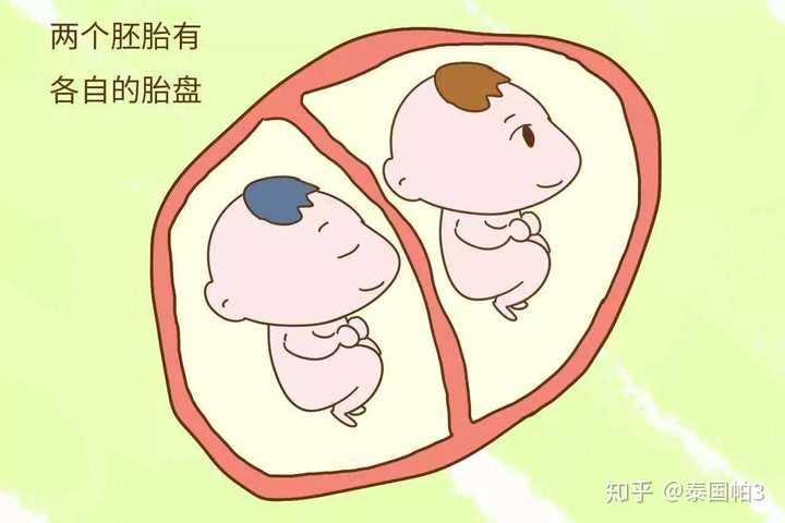 梦见自己生两对双胞胎_头胎双胞胎能生二胎吗_怎么生双胞胎