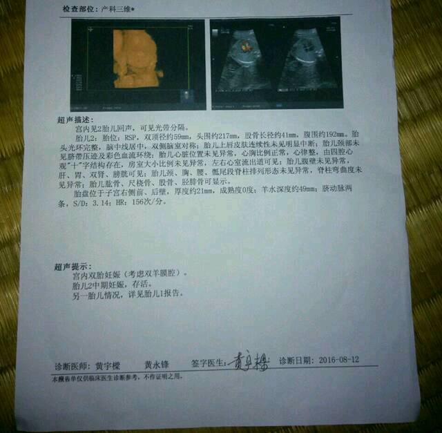 怎么生双胞胎_梦见自己生两对双胞胎_头胎双胞胎能生二胎吗