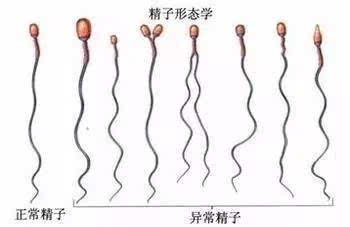弱精症调理_弱精症_弱精症的原因