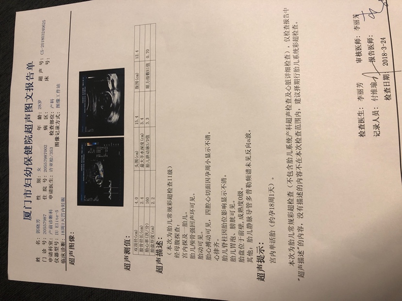 胎儿nt 检查_胎儿 nt检查_nt检查