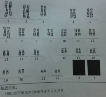 nt检查_胎儿 nt检查_胎儿nt 检查