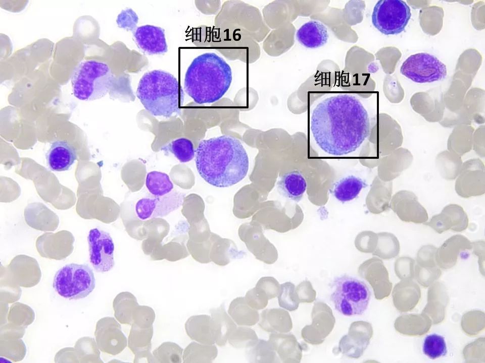白细胞_环孢菌素a抑制哪种细胞th细胞_白假丝酵母菌是单细胞还是多细胞