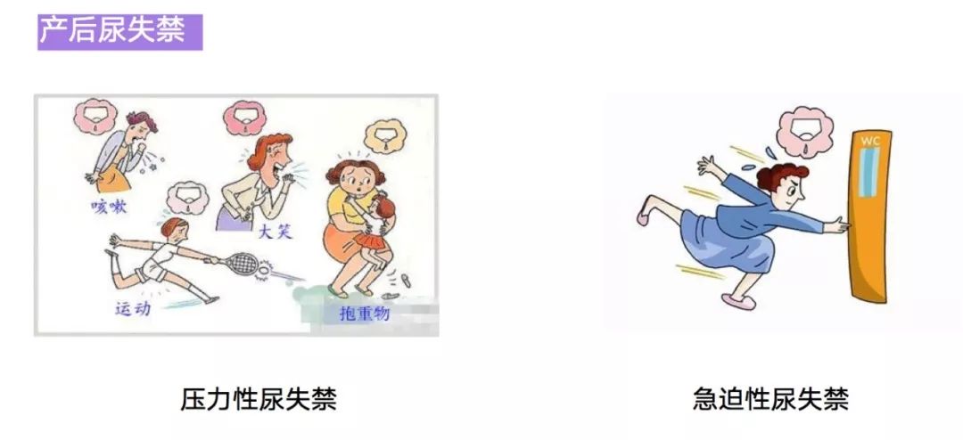 盆底肌修复