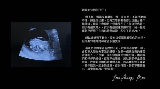 唐氏综合症