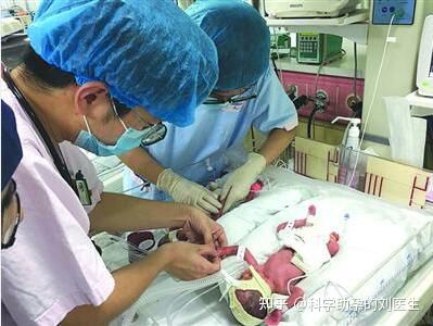 多胎妊娠
