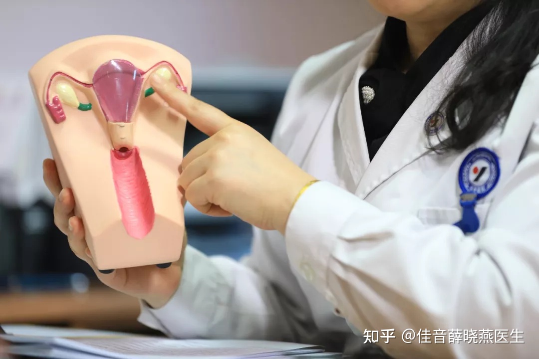 多囊卵巢