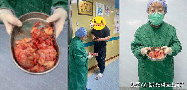 什么是子宫腺肌症_子宫腺肌症_子宫腺肌症子宫腺肌瘤