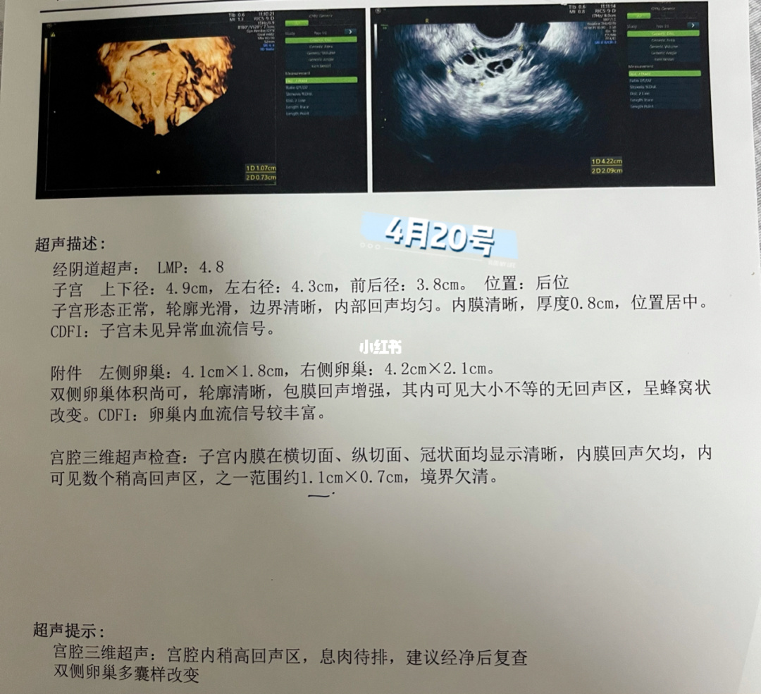 宫腔镜检查_宫腔镜检查?_什么情况做宫腔镜检查
