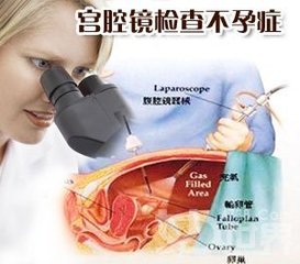什么情况做宫腔镜检查_宫腔镜检查?_宫腔镜检查