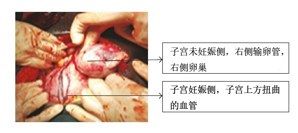 宫腔环境检查_宫腔镜检查后_宫腔镜检查术