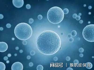 子宫腺肌症