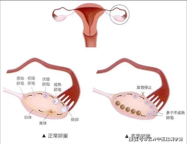 催乳师催乳有用吗_变性人催乳激素_催乳激素