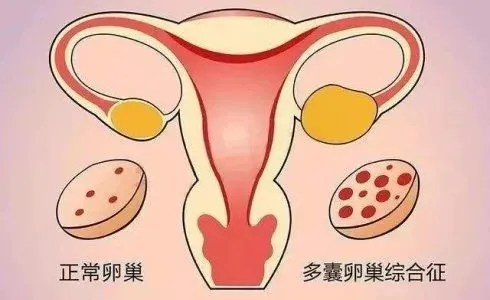 变性人催乳激素_催乳激素_催乳师催乳有用吗