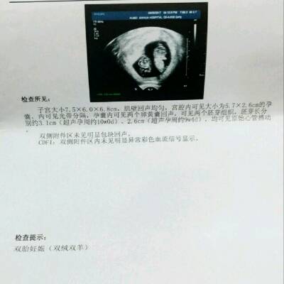 双胞胎怎么生_怎么生双胞胎_头胎双胞胎能生二胎吗