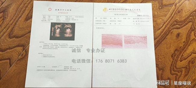 唐氏筛查综合值是1::425,参考值是1:250_牧彤拖延症的自我疗法：七周扫除拖延症^^^好心态好前程：成功_唐氏综合症