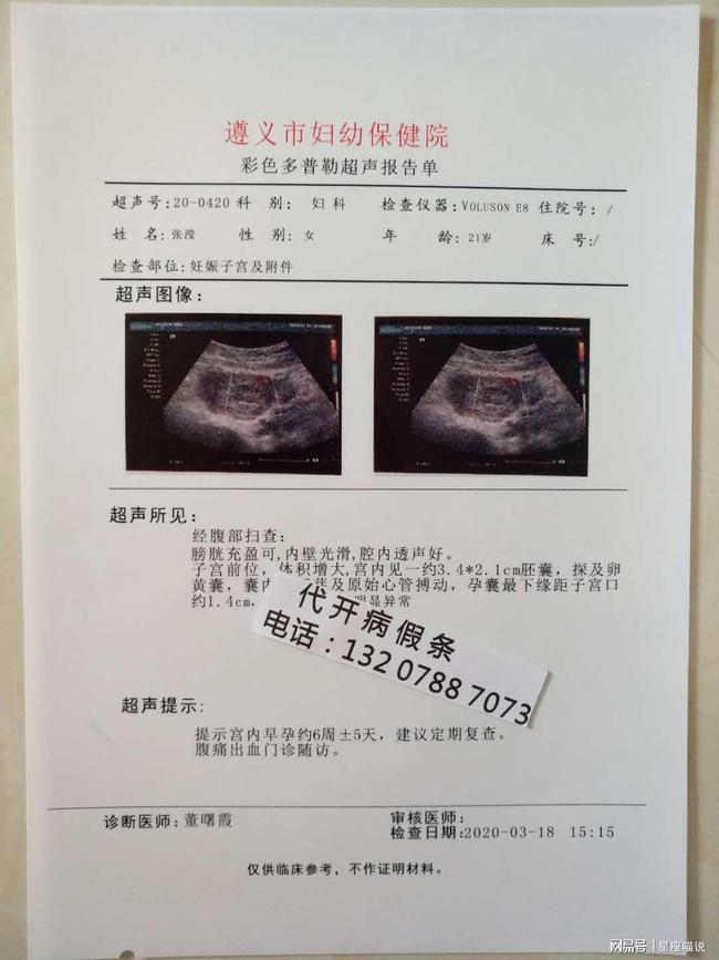 牧彤拖延症的自我疗法：七周扫除拖延症^^^好心态好前程：成功_唐氏综合症_唐氏筛查综合值是1::425,参考值是1:250