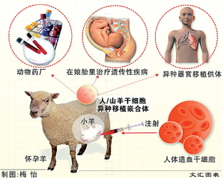 马凡氏综合症_马凡综和症_特纳氏综合症是怎么得的
