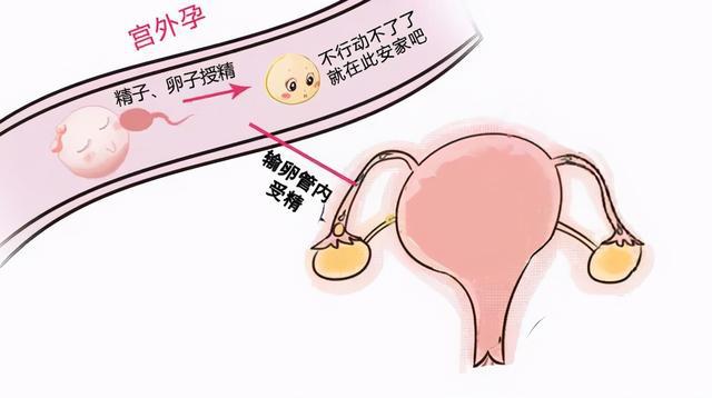 妊娠黄体和月经黄体_黄体素_月经黄体和妊娠黄体