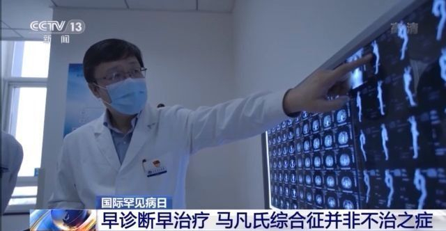 马凡氏综合症