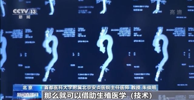 马凡氏综合症