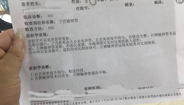 输卵管造影_怎么做输卵管 造影_造影能疏通输卵管吗