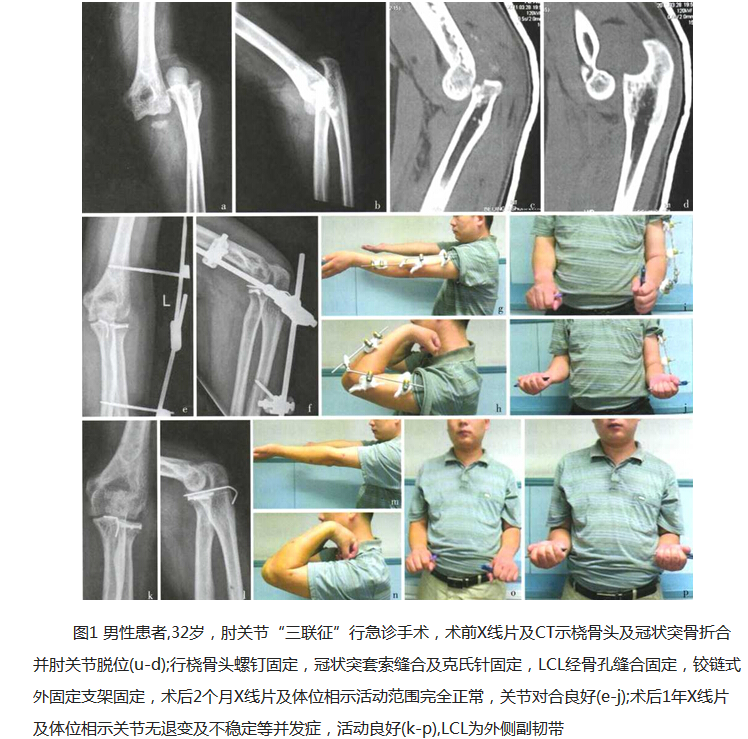 特纳氏综合症是遗传病吗_马凡氏综合症_法乐氏三联症