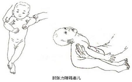 新生儿做检查会检查什么项目_新生儿检查项目_新生儿检查肝功