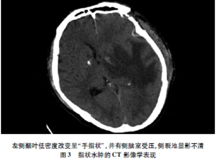 梅毒抗体弱阳性_梅毒抗体_梅毒抗体