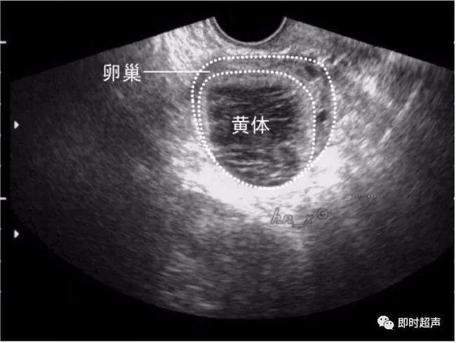 卵泡期促黄体生成素高_黄体期_妊娠黄体和月经黄体